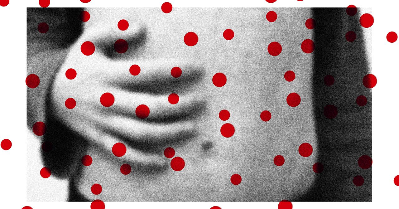 Os casos de sarampo estão aumentando. Outras doenças evitáveis ​​podem seguir