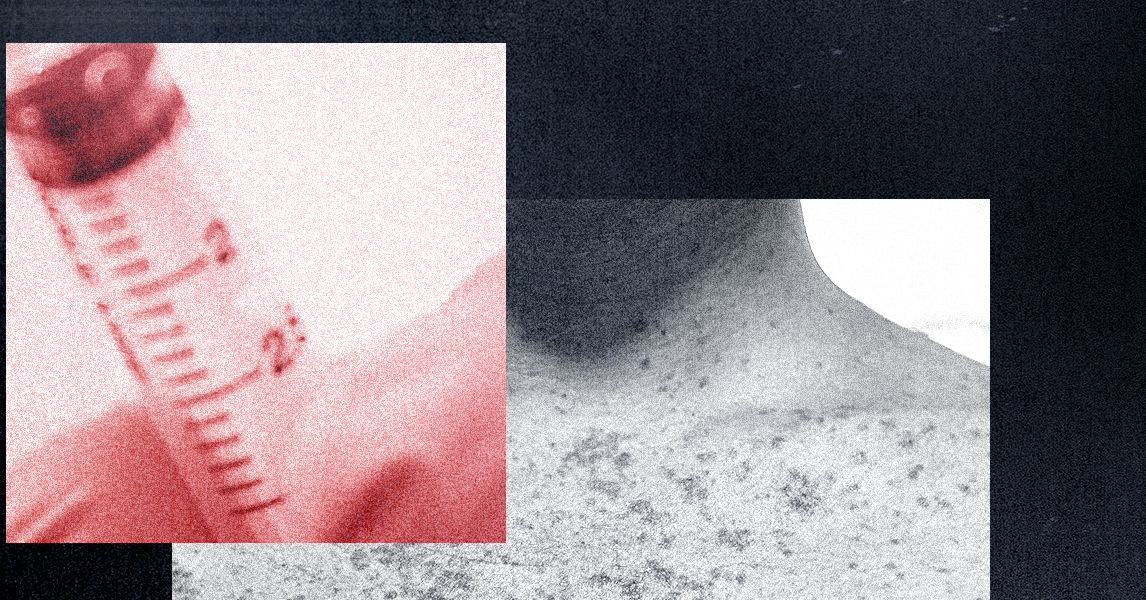 Os anti-vaxxers estão rindo do surto de sarampo-e afirmam