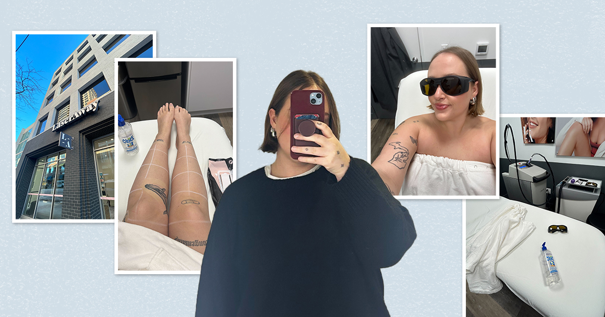 Laseraway é bom? Eu tentei a remoção do cabelo a laser – tudo que eu gostaria de saber
