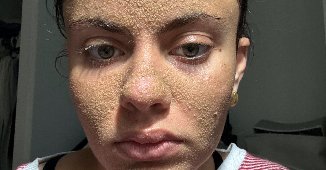 A rotina de cuidados com a pele do ‘Caveman’ deste tiktoker tem céticos, mas ela diz que está ajudando