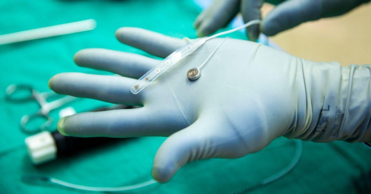 Um rival Neuralink acabou de testar um implante cerebral em uma pessoa