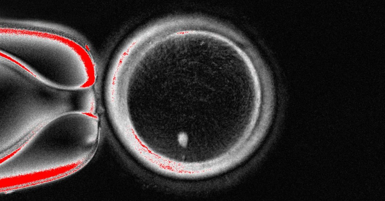 Os cientistas fizeram ovos humanos com células da pele e os usaram para formar embriões