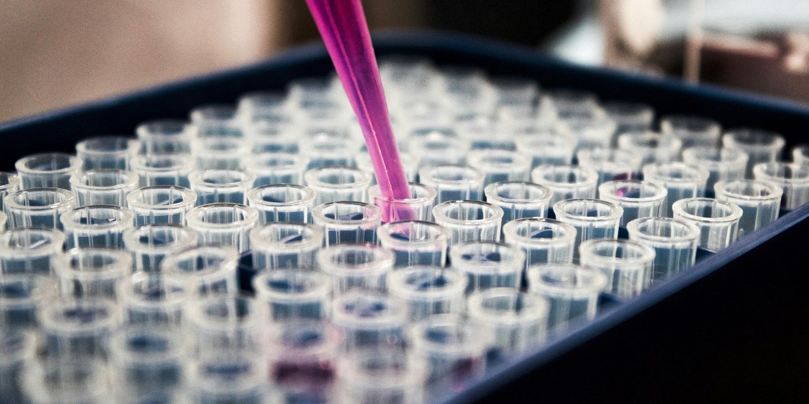 Pesquisas brasileiras avançam no diagnóstico de Alzheimer