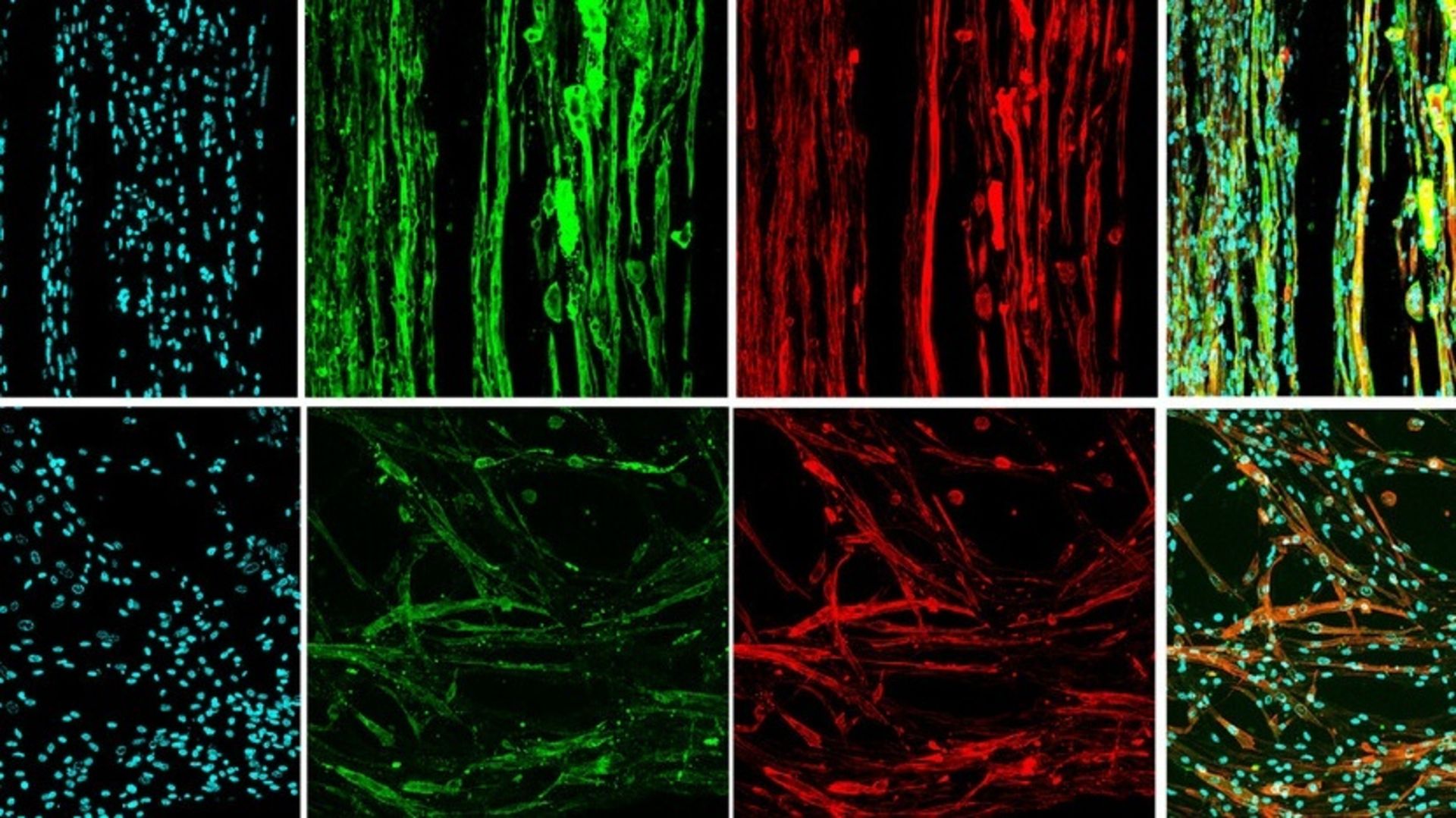 Cientistas imprimiram tecido muscular em 3D em microgravidade. O objetivo é fazer órgãos humanos do zero