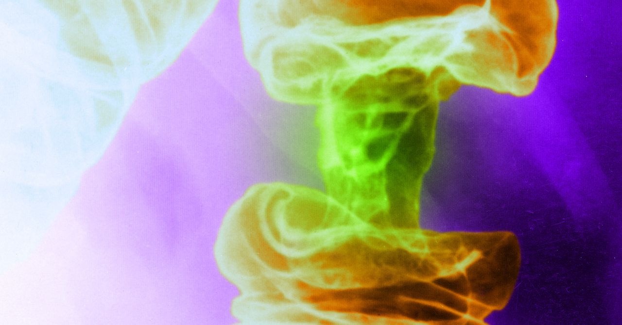 Um novo tratamento contra o câncer baseado em luz mata células tumorais e poupa células saudáveis