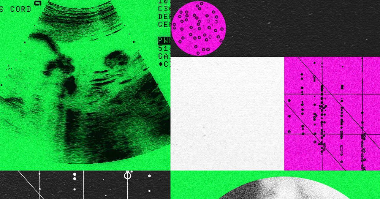 Empresas de designers de bebês estão em crise