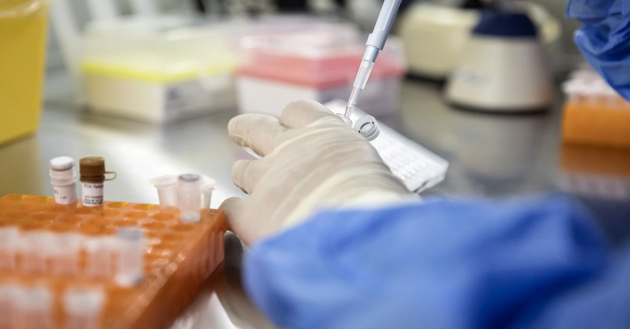 Supercarregar células imunológicas pode ajudar a controlar o HIV a longo prazo